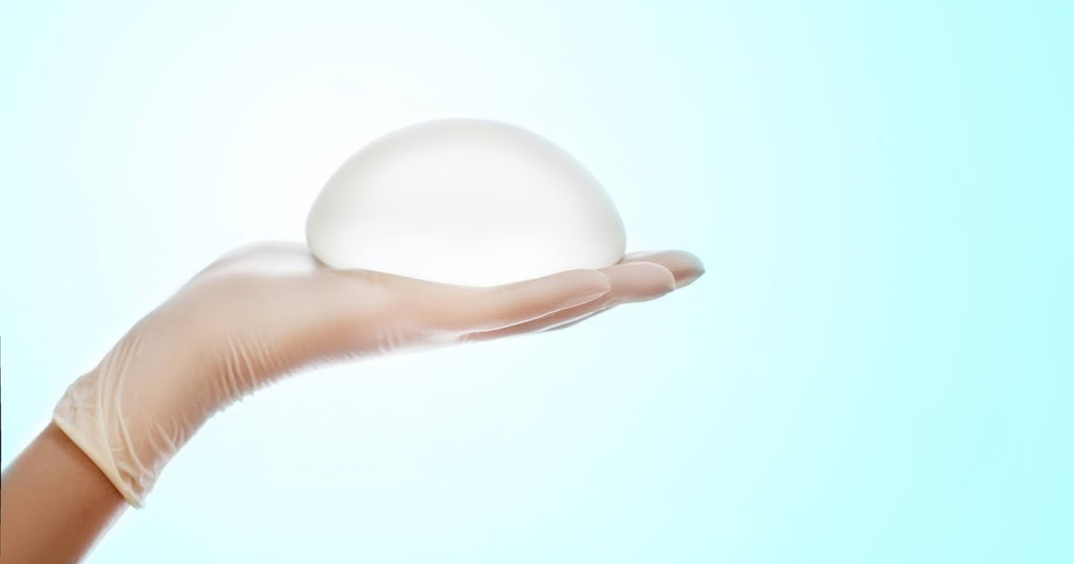Thời gian sử dụng của túi ngực là bao lâu?