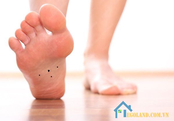 Nốt ruồi ở chân, lòng bàn chân, bắp chân Nam & Nữ ý nghĩa gì?