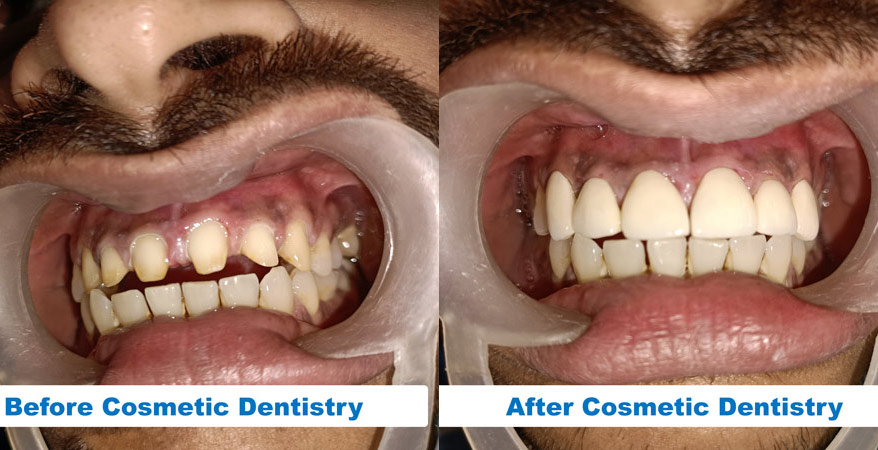Best Cosmetic Dentist In Kolkata | Cosmetic Dentistry in Kolkata