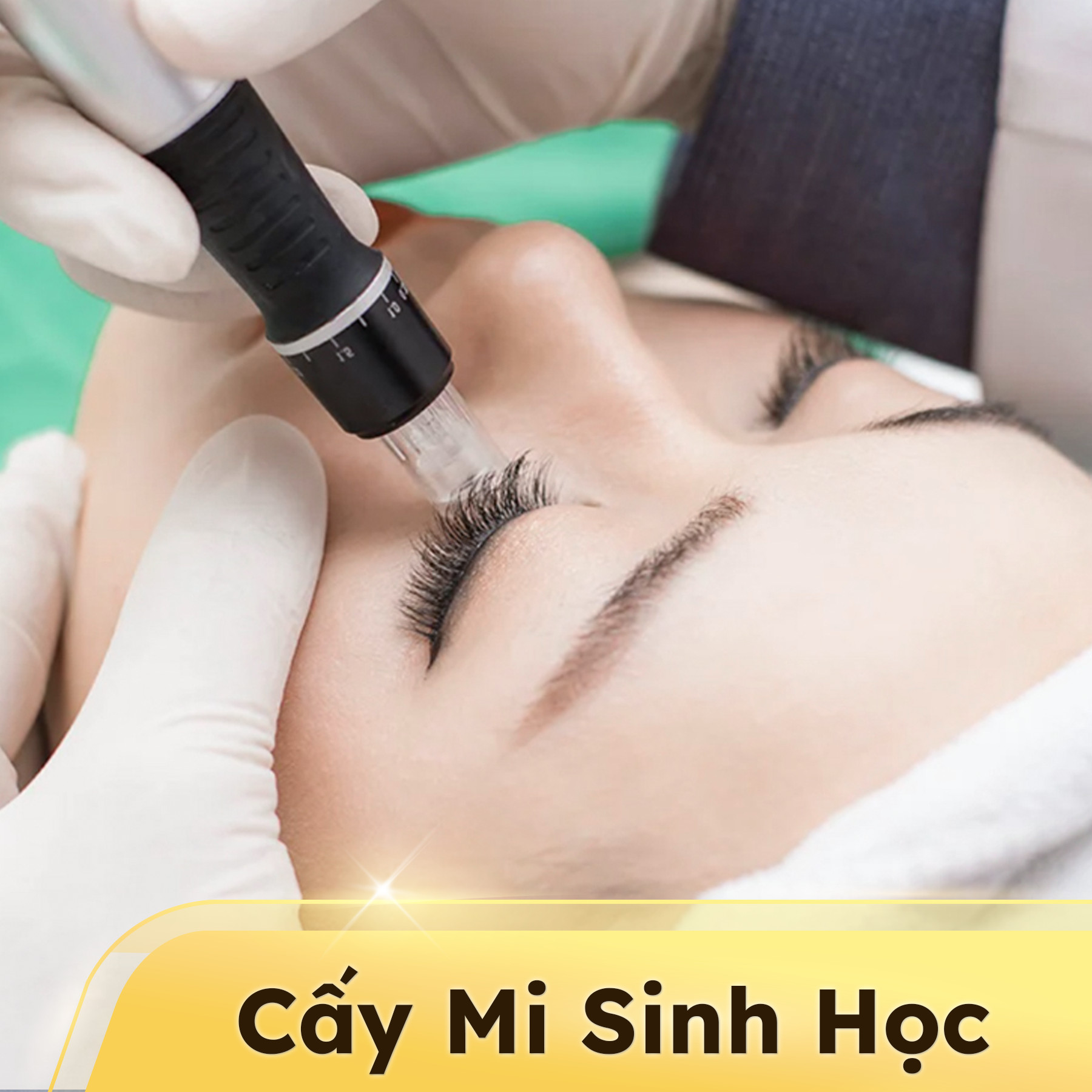 Cấy mi sinh học là gì? Cấy mi sinh học có tốt không?