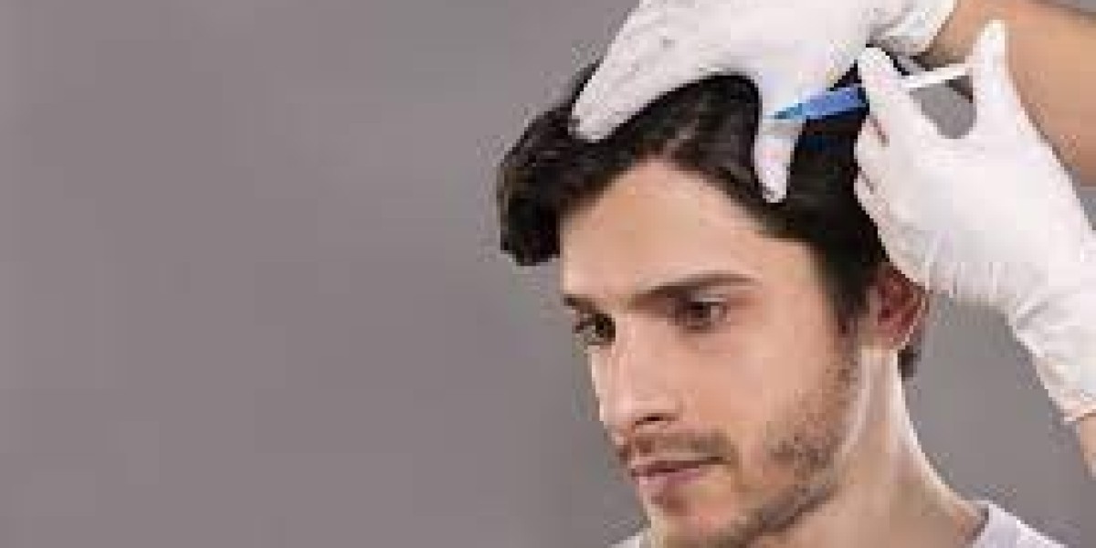 9 Ridiculously simple ways to improve the way you PRP hair treatment in Dubai