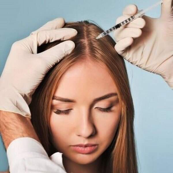 PRP Hair Treatment in Dubai like a pro with the help of these 9 tips