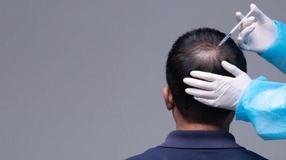 DHI Hair Implantation Procedure Explained by dynamicclinic | Baskadia