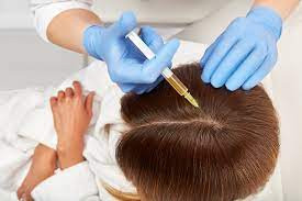 PRP Hair Treatment versus Other Going bald Arrangements :: Dynamic Clinic