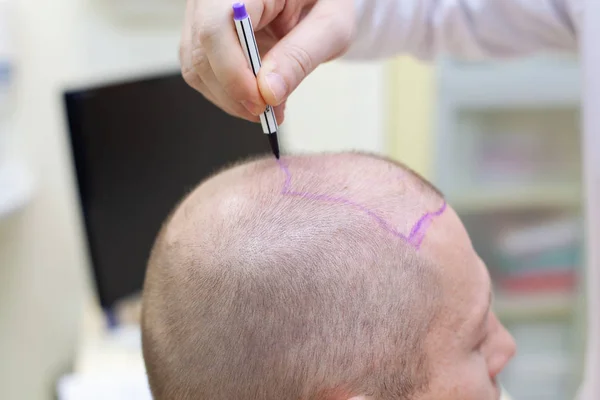How Might Hair Relocate In Dubai Be From now on. – Site Title