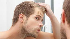Finding Value in the Desert: Affordable Hair Transplants in Dubai – Site Title