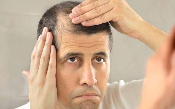 Availability of skilled surgeons for Hair Restoration in Dubai