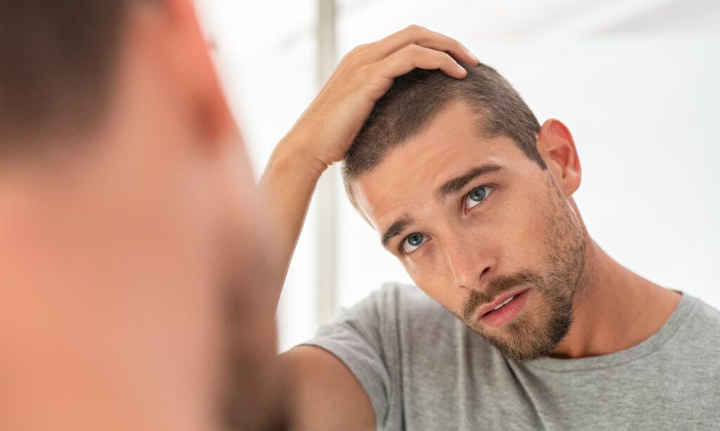 From Bald to Beautiful: Your Journey to Hair Transplant in Dubai Begins Here | by Eishadynamic | May, 2024 | Medium