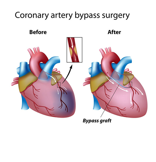 Heart Specialist Hospital in Ahmedabad, Best Heart Specialist in Ahmedabad, Best Cardiologist & Cardiac Surgeon/Doctor in Ahmedabad, India, Best Doctor for Bypass Surgery