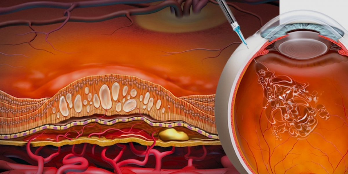 Regeneron Pharmaceuticals: Pioneering Anti-VEGF Innovations with Eylea's New Delivery System
