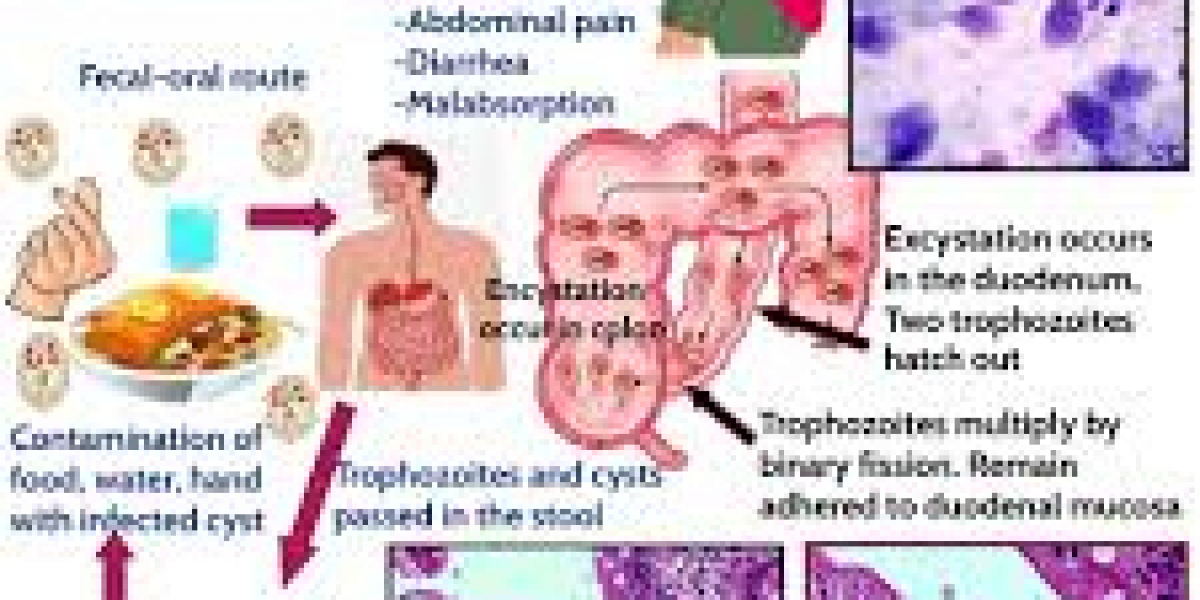 What is Giardiasis and How Can You Avoid It?