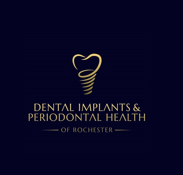 DENTAL IMPLANTS And PERIODONTAL HEALTH