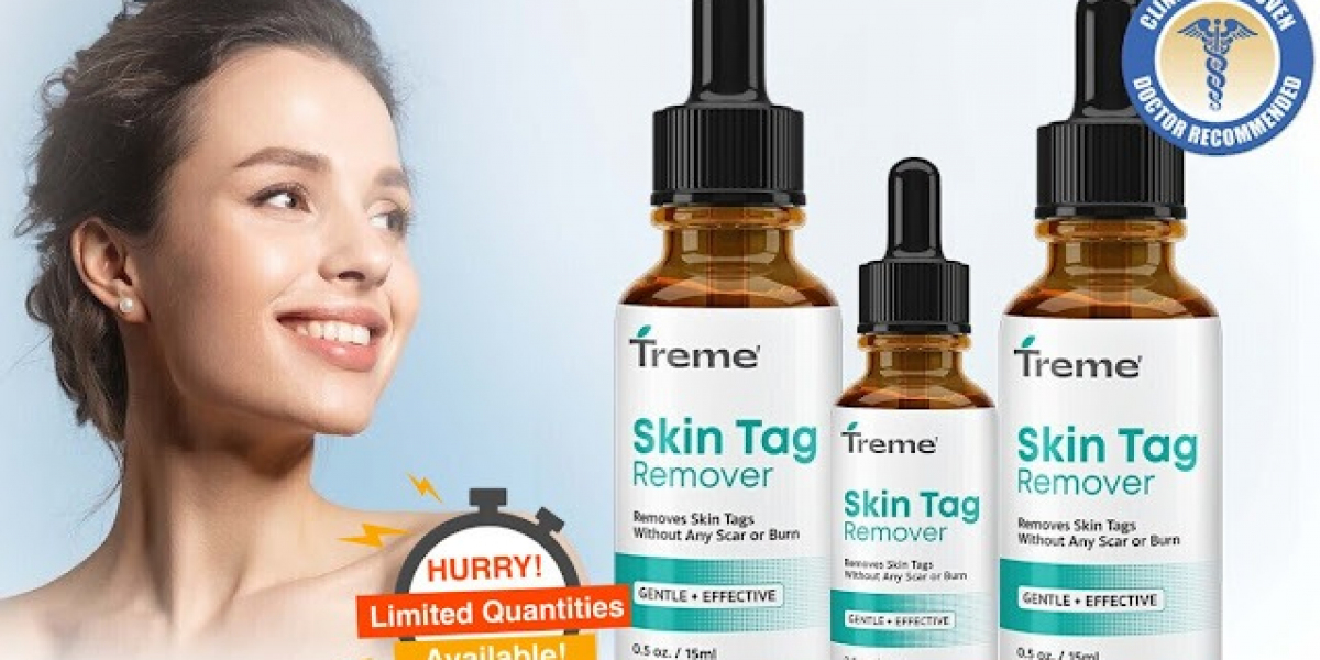 Treme Tag Remover "Official Website" & Its Reviews – Use It