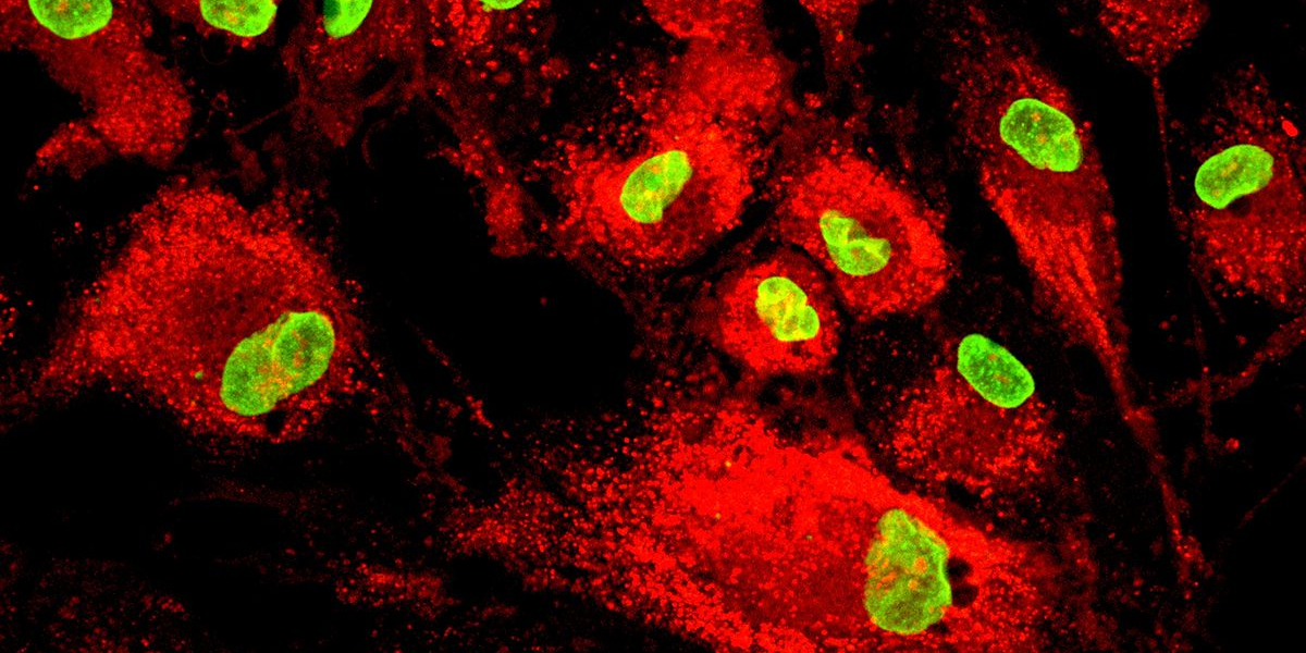 Mesenchymal Stem Cells market to witness highest growth owing to increasing clinical trials