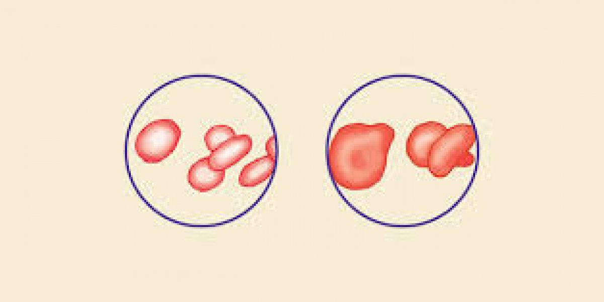 Rheumatoid Arthritis and Ulcerative Colitis: Understanding the Connection and Management