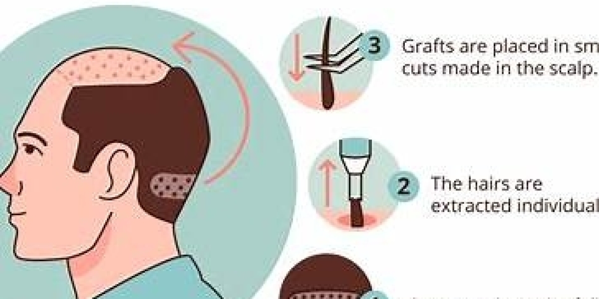 Liposuction in Karachi – Achieve a Contoured Body at AHTCS