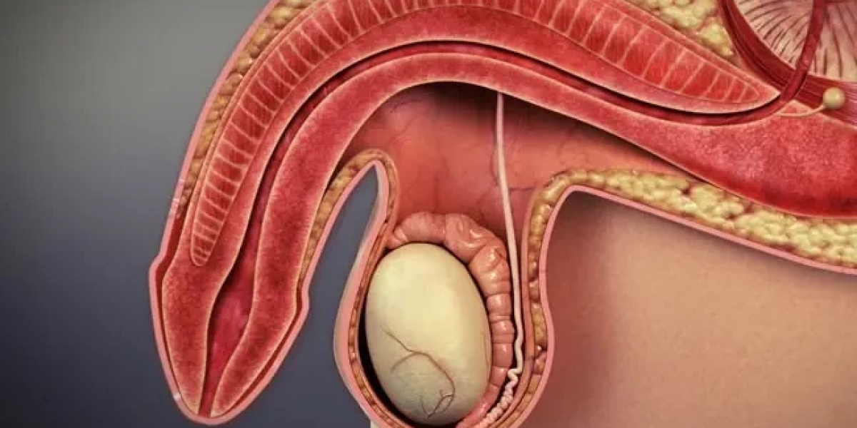 Ayurvedic Treatment for Erectile Dysfunction (ED): Restoring Passion and Intimacy Naturally