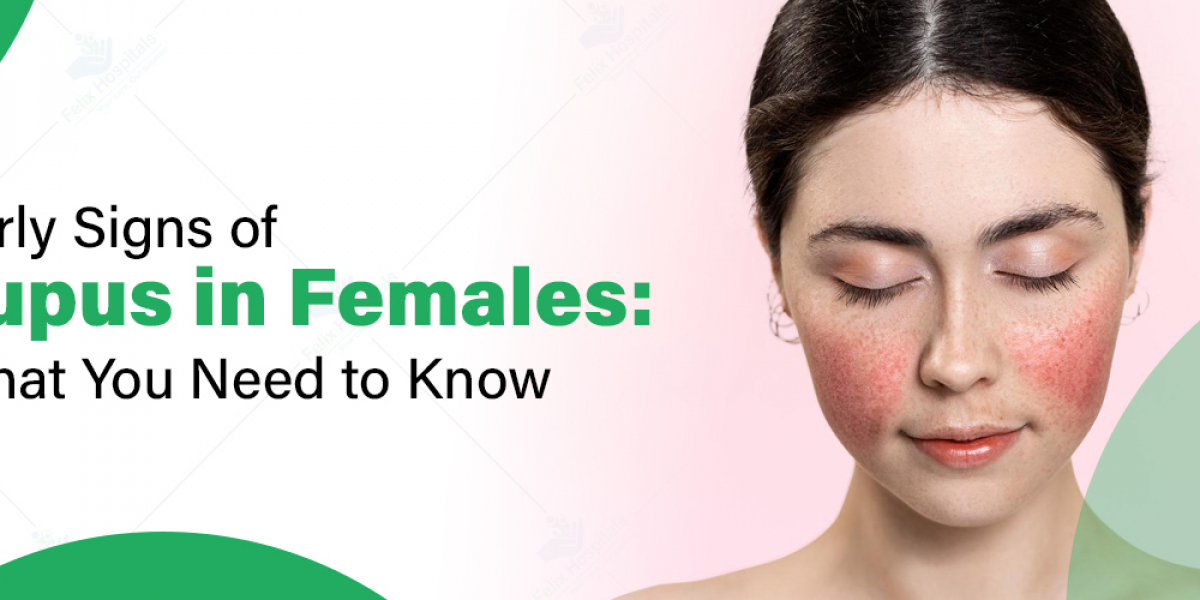 Lupus Symptoms in Women: Early Signs, Diagnosis, and Managing the Complexities of SLE