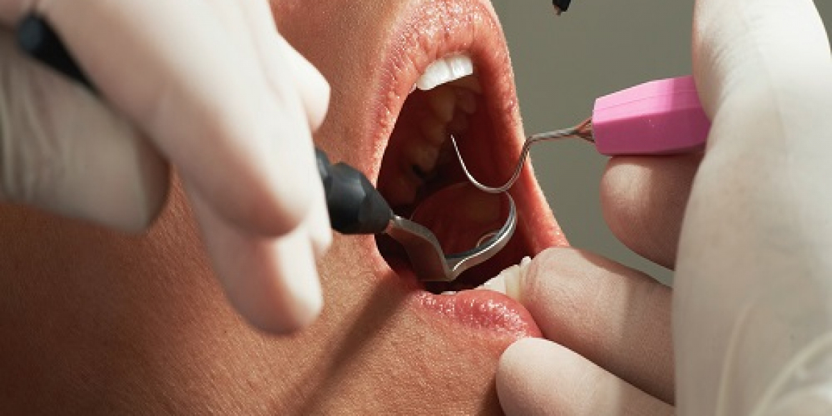 Why Every Family Needs a Reliable Dentist