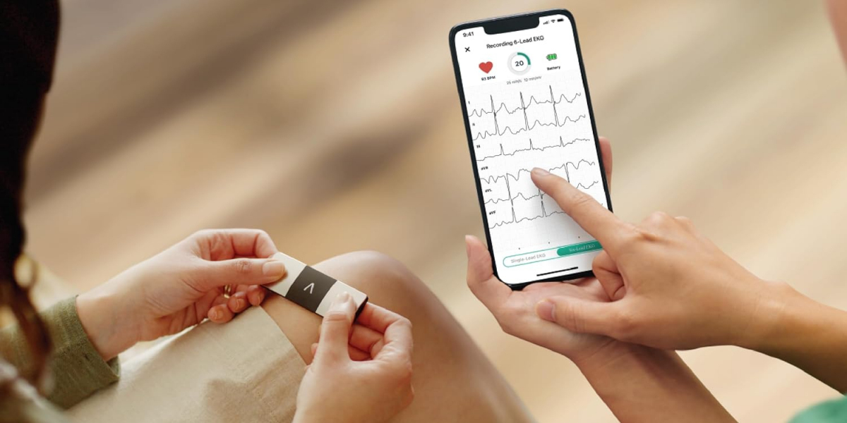 Wireless ECG Devices Market 2031: Analysis, Trends, and Outlook