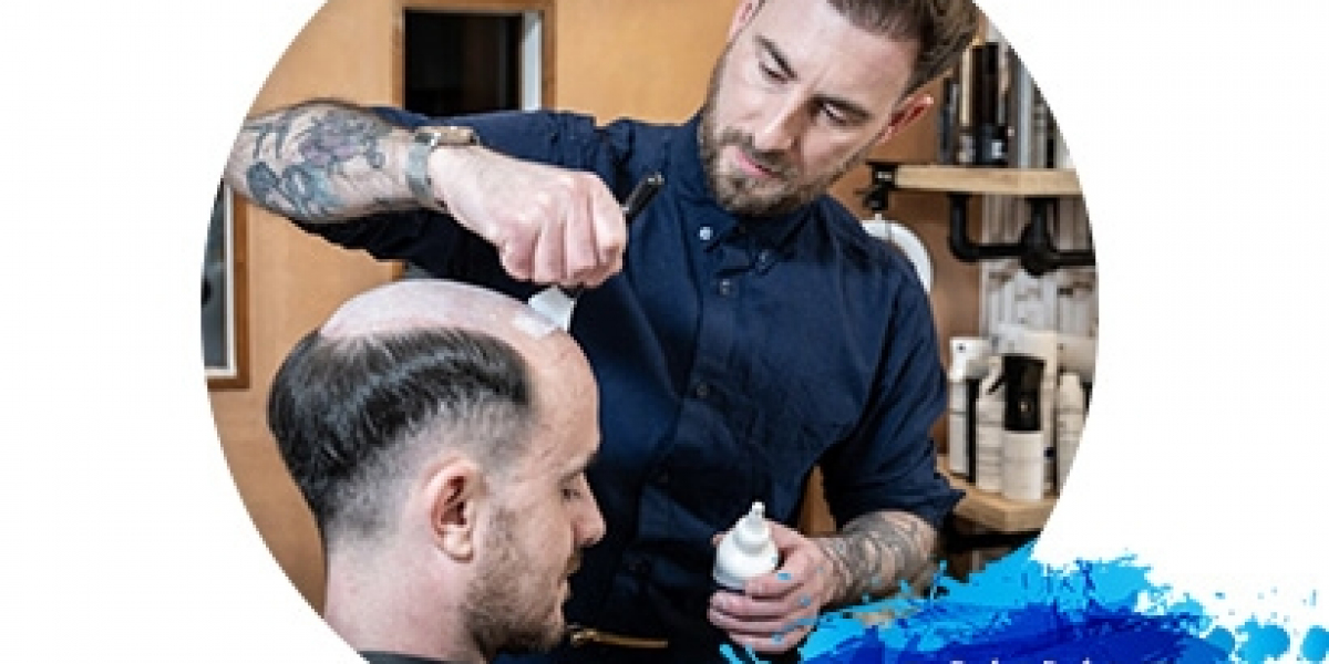 What Is a Hair System and How Does It Work?