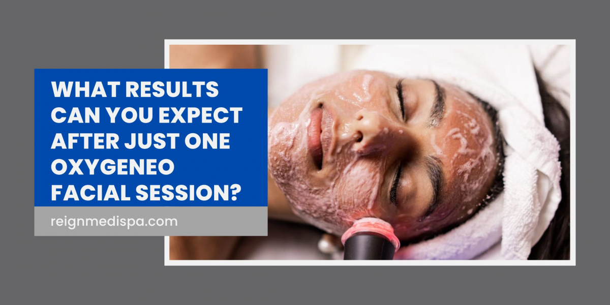 What Results Can You Expect After Just One OxyGeneo Facial Session?
