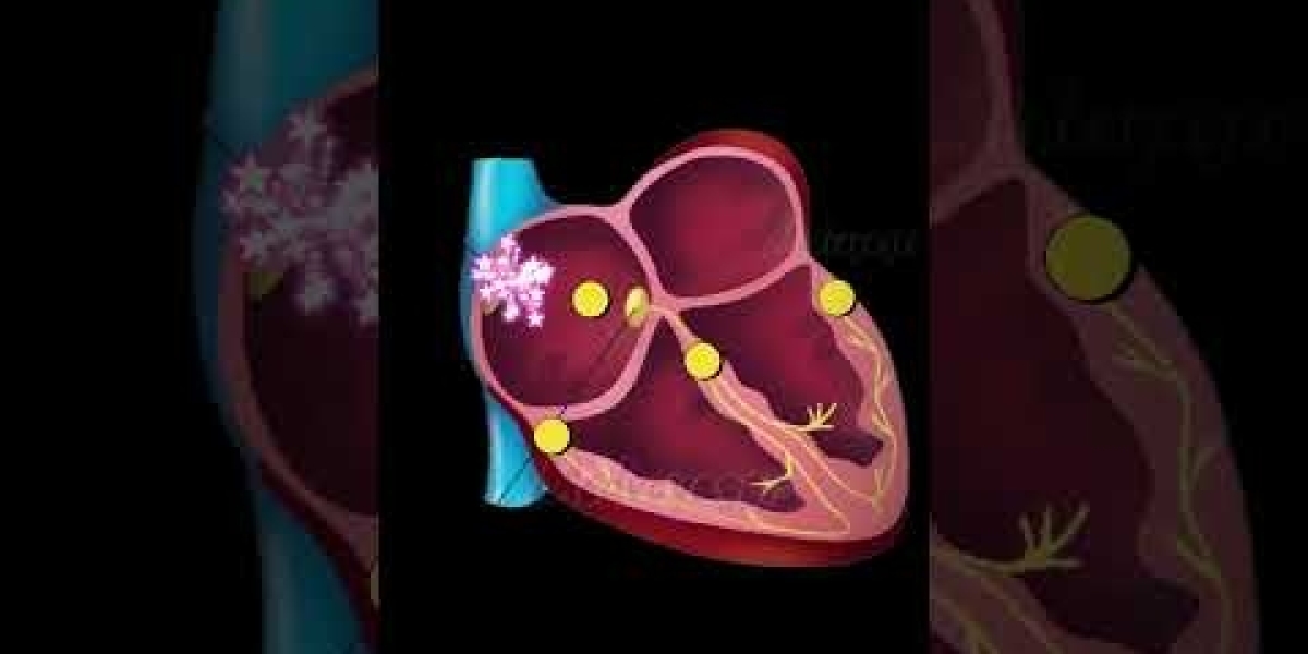 atrial fibrillation (Afib) market growth driven by aging population, advanced therapies, and innovative technologies