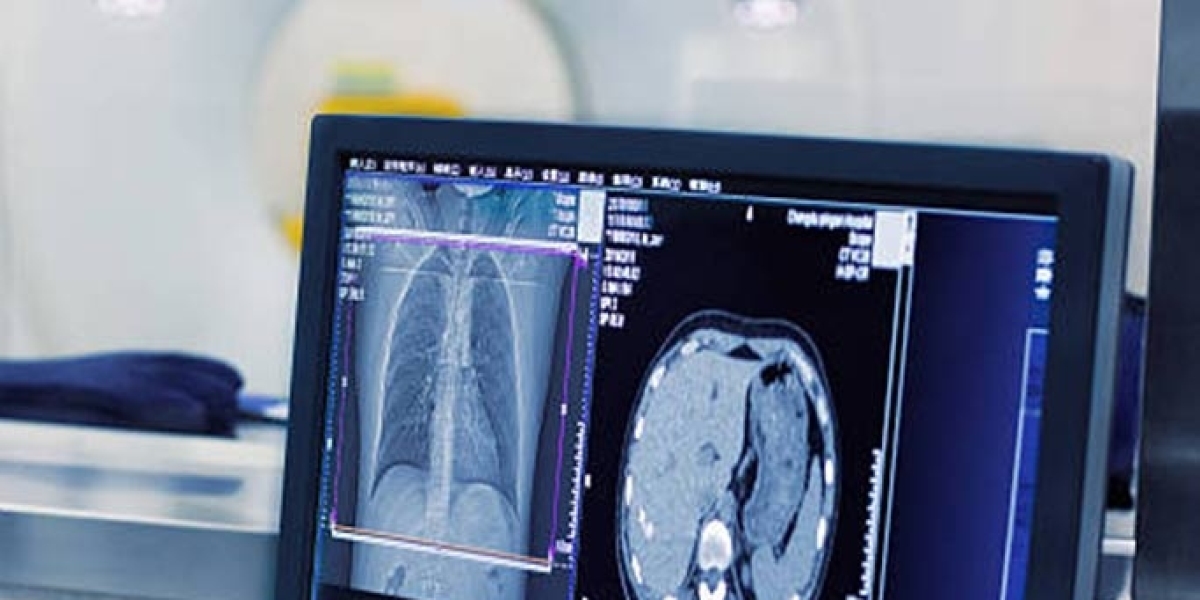 Reliable X-Ray Machines for Clinics and Hospitals