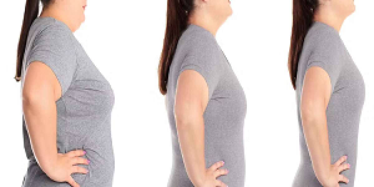 Your Trusted Weight Loss Clinic in Oklahoma for Lasting Results