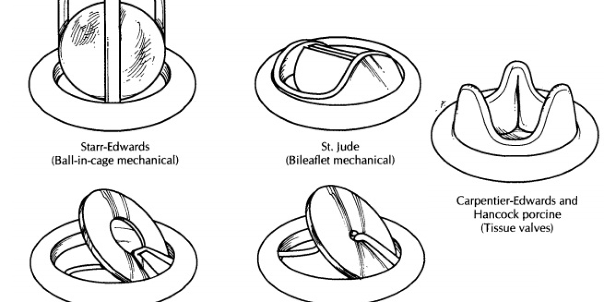 Prosthetic Heart Valves Market Shaping Future of Cardiac Care Through Advanced Implantable Technologies