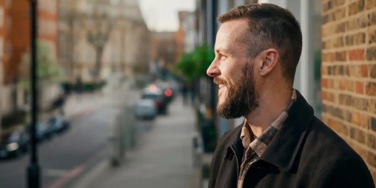 Hair Transplant London: Long-Term Results and Hair Growth Journey