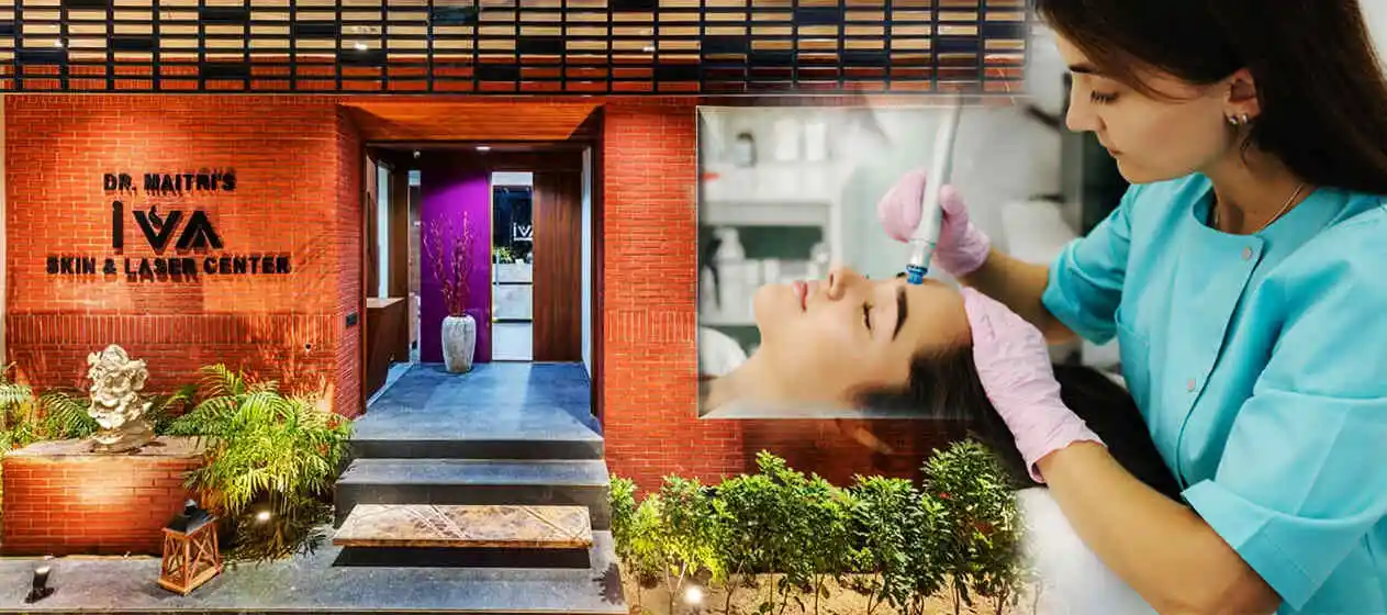 Skin Laser Treatment in Ahmedabad | iVA Skin & Laser Center