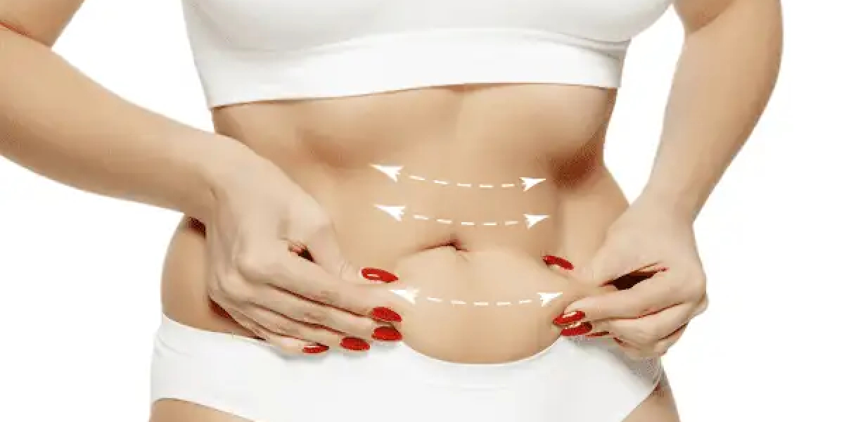 How Mommy Makeover Lounge Personalizes Every Patient's Surgical Plan